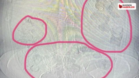 Sakarya merkezli uyuşturucu operasyonu: 67 parça metamfetamin ele geçirildi